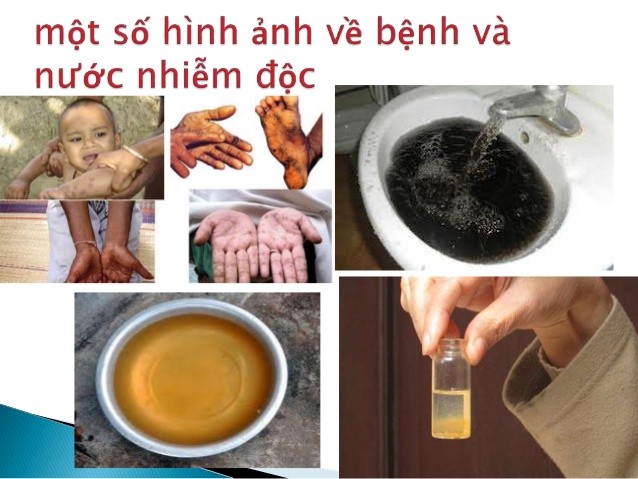 Hình ảnh nước nhiễm sắt (nâu) và mangan (đen)