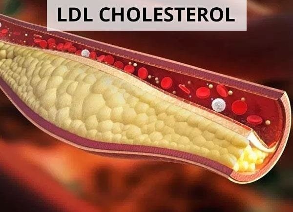 Axit linoleic giúp giảm cholesterol LDL trong máu và cải thiện đáng kể huyết áp