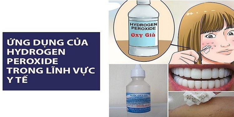 ứng dụng của h2o2 trong y học